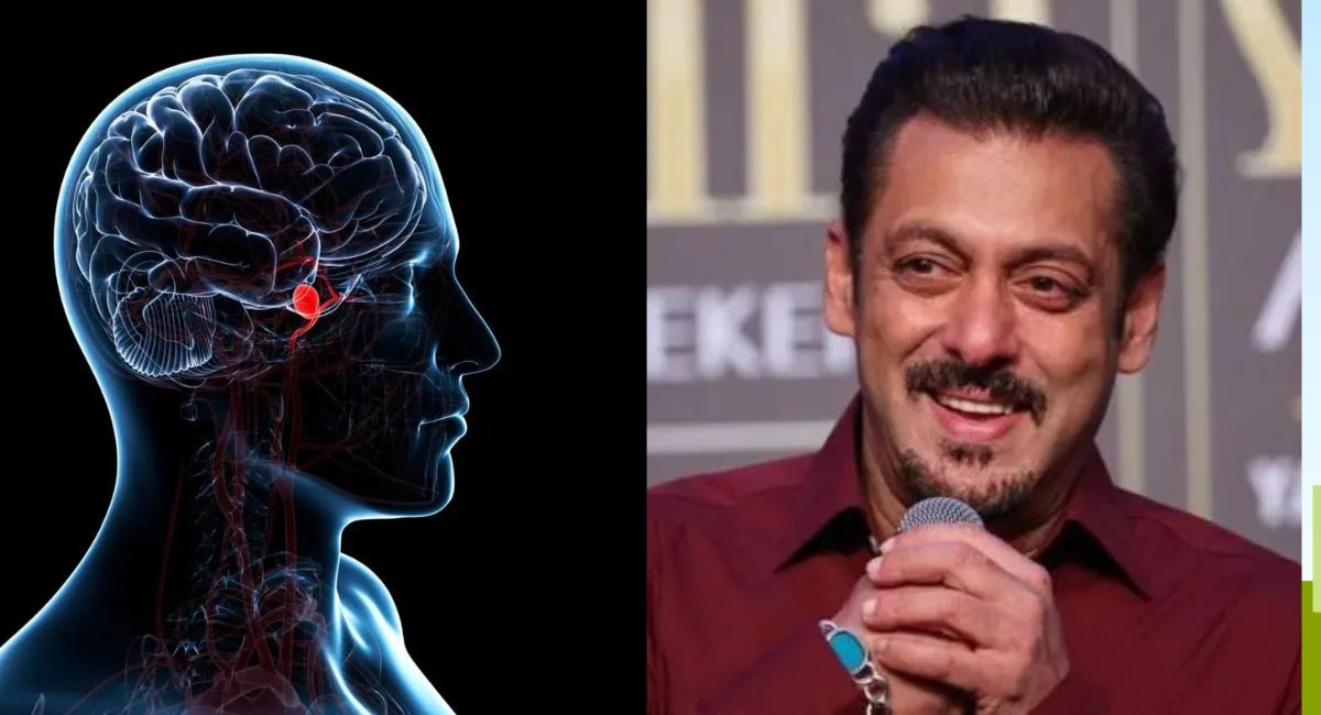 सलमान खानलाई भएको ‘ब्रेन एन्युरिजम्’ के हो? जान्नुहोस् लक्षण, कारण, उपचार र बच्ने उपाय