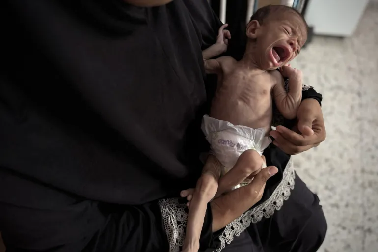 गाजामा शिशुहरूको भोकमरी: दूध र आहारको अभावमा नवजात शिशुहरू संकटमा