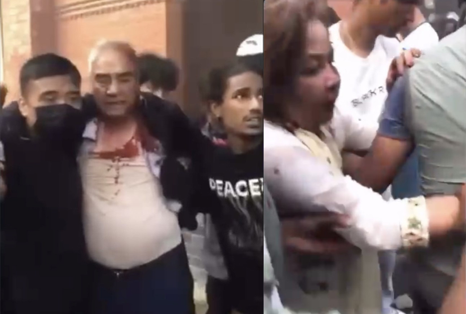 शेरबहादुर देउवा र पत्नी आरजु राणा घाइते