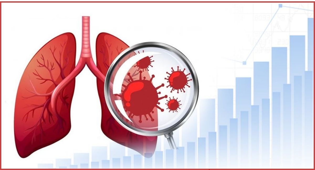 एक सय जनामा क्षयरोग सङ्क्रमण
