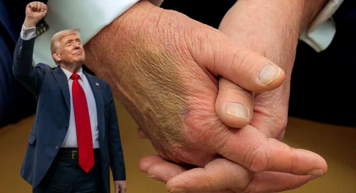 डाक्टरले भनेभन्दा बढी एस्पिरिन किन खान्छन राष्ट्रपति ट्रम्प ?